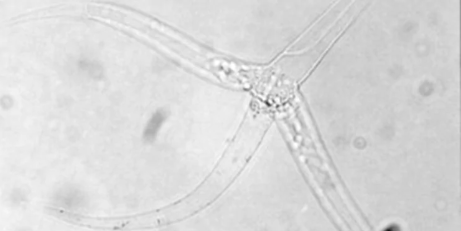 See the tiniest creature on Earth